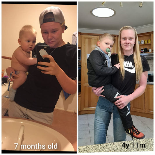Two images of a mum carrying special needs 5 year old on her hip, left image of baby at 11 months old, right image of 5 year old child